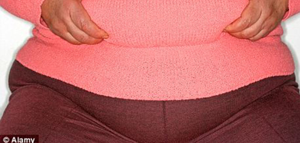obesity