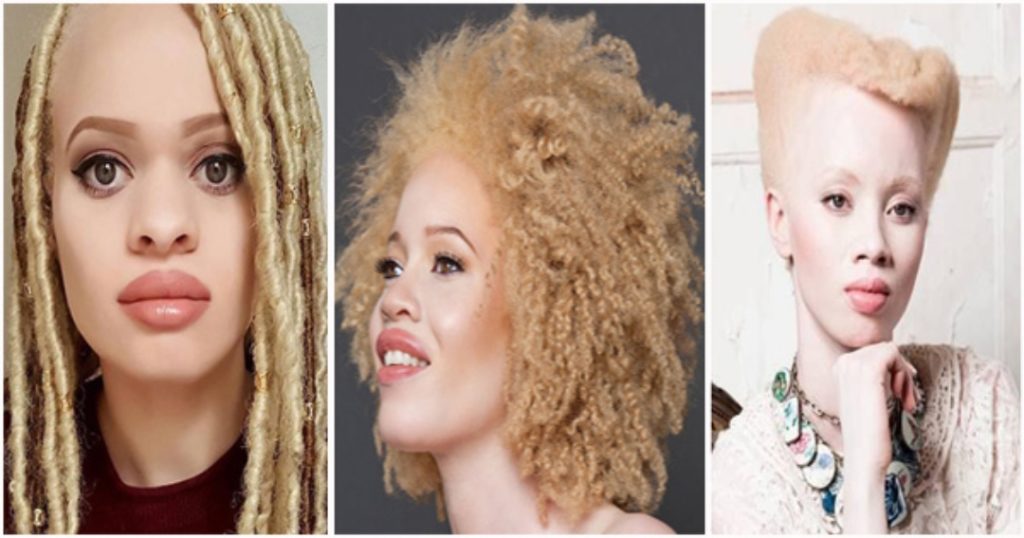 Lifestyle suitable for albinos