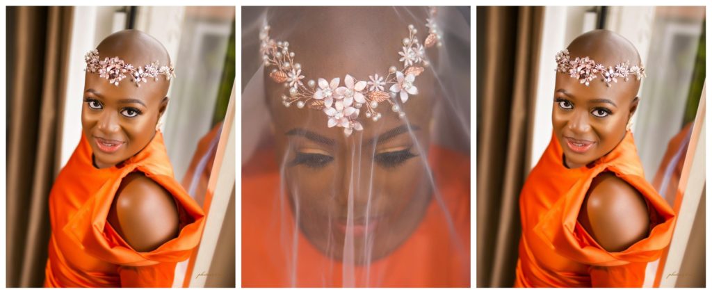 #BaldBride: Would you go bald on your wedding day?