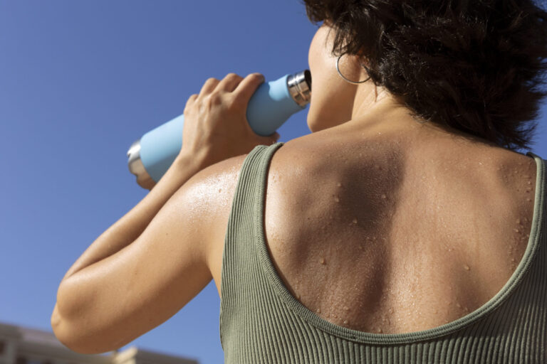 How to manage overperspiration How to manage overperspiration