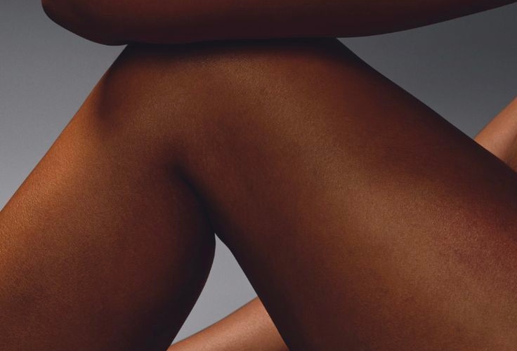 Dark thigh pigmentation: Tips for a more even skin tone Dark thigh pigmentation